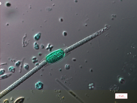 Anabaena_ChristopheLaplace